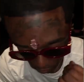 美国说唱歌手在额头安装11克拉粉钻 额头穿孔